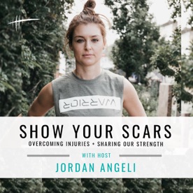 Podcast: Show Your Scars